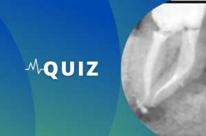 Image Quiz Retraitement endodontique