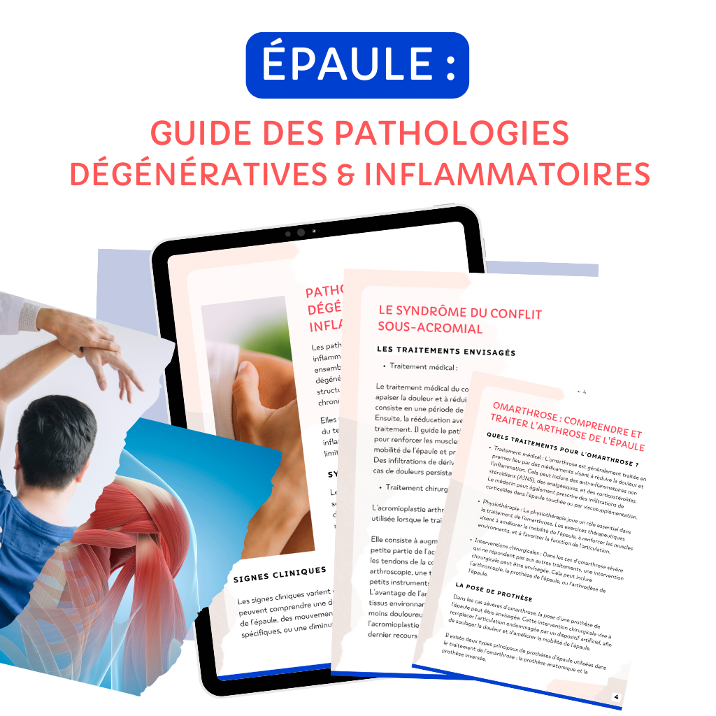 Ebook Pathologies dégénératives et inflammatoires de l’épaule